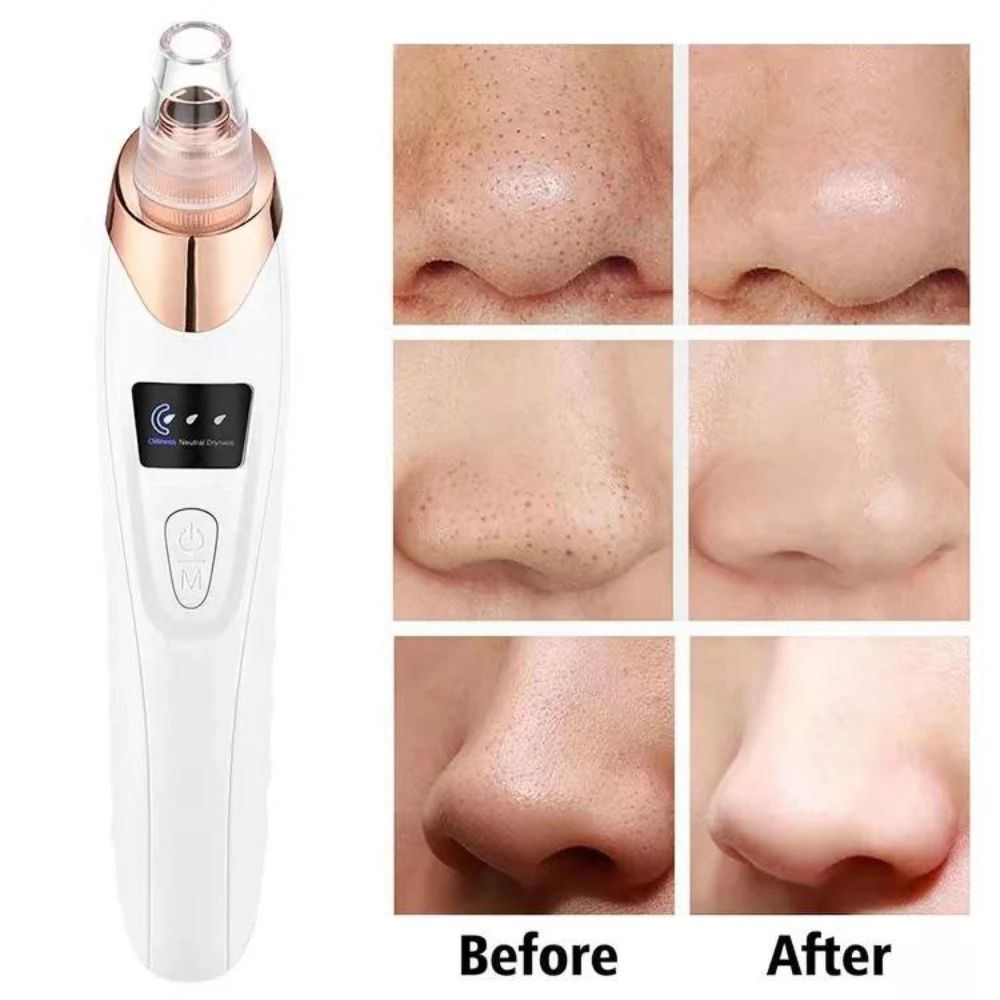 Rechargeable Blackhead Suction Tool